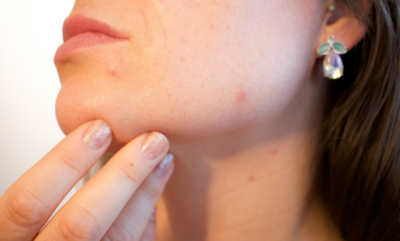 5 Effective Scar Treatment Options